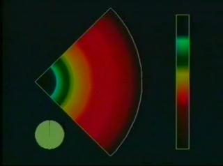 Evolution of the density during the first 20 milliseconds in the life of a neutron star formed from a Type II supernova